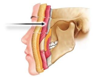 Skeletal illustration of profiled skull with arrow pointing past eyes to center skull